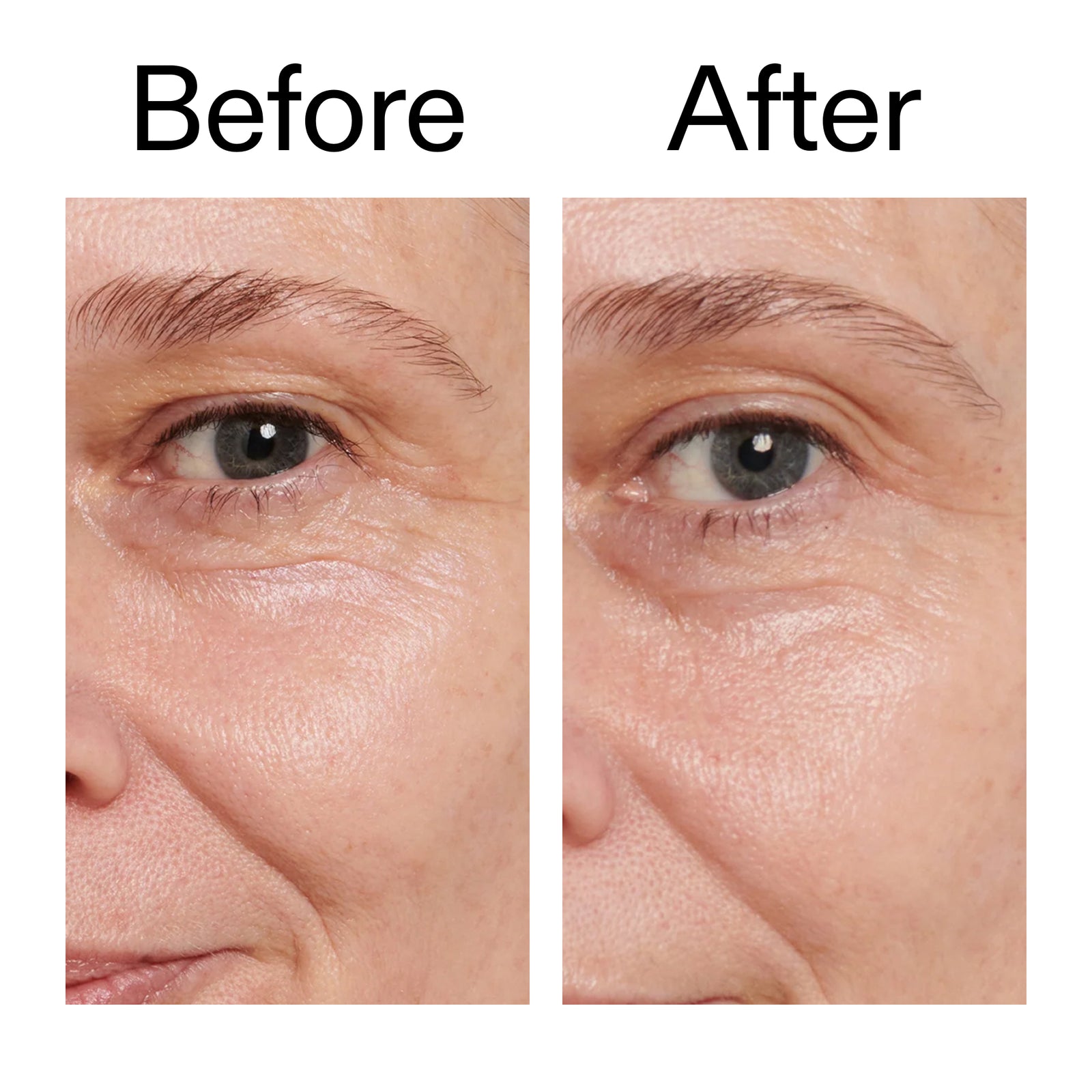 Before and after comparison of a person's eye area with visible aging signs.