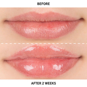 Before and after comparison image showing visible results after 2 weeks of using Tripeptide Plumping Lip Balm