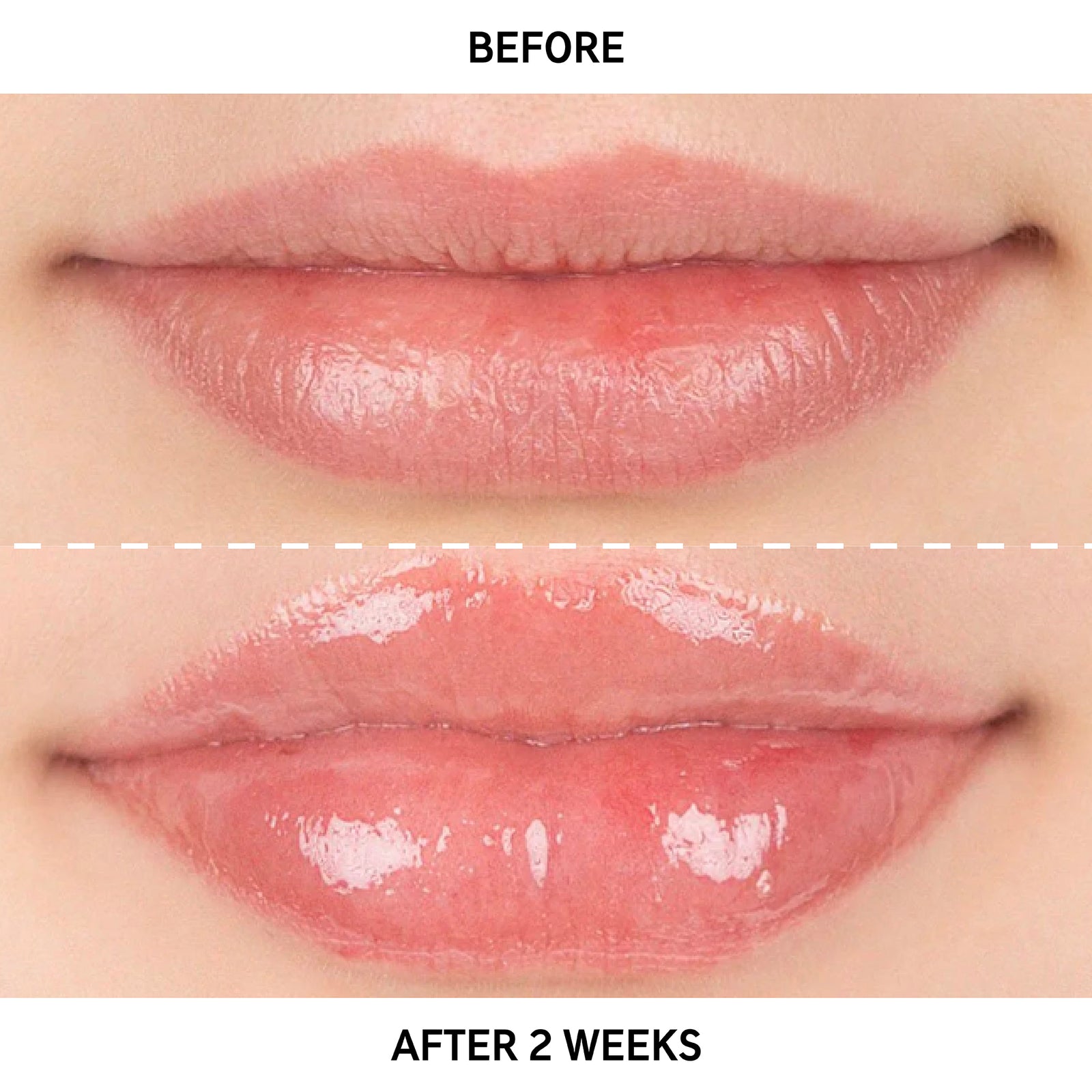 Before and after of using Tripeptide Lip Balm