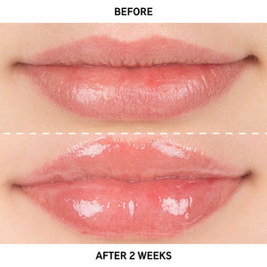 Before and after of using Tripeptide Lip Balm