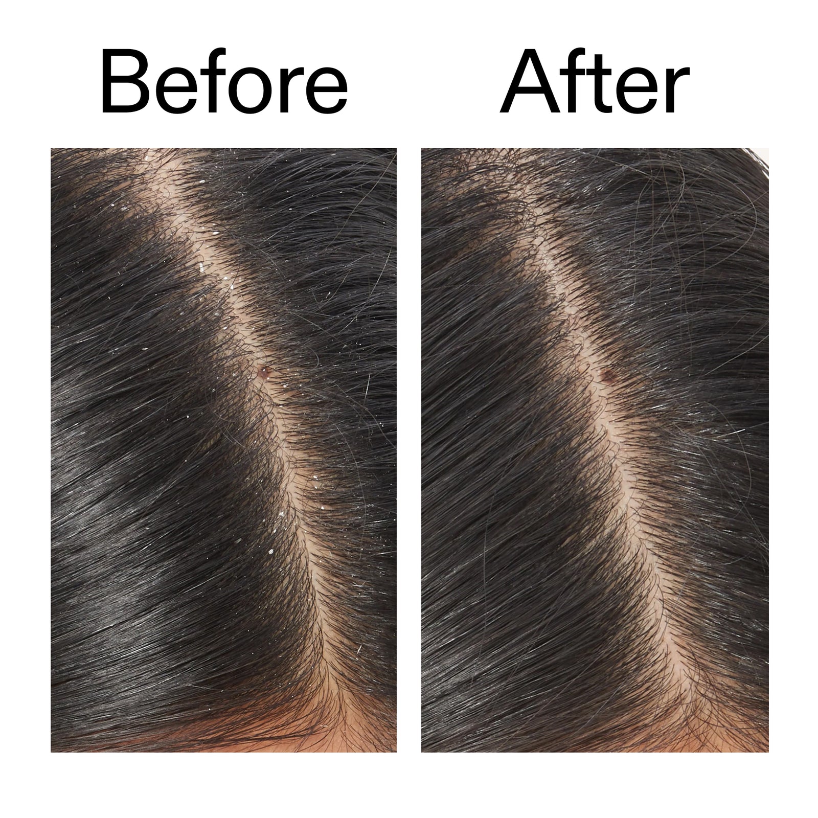 Before and after comparison of hair texture with 'Before' on the left and 'After' on the right.