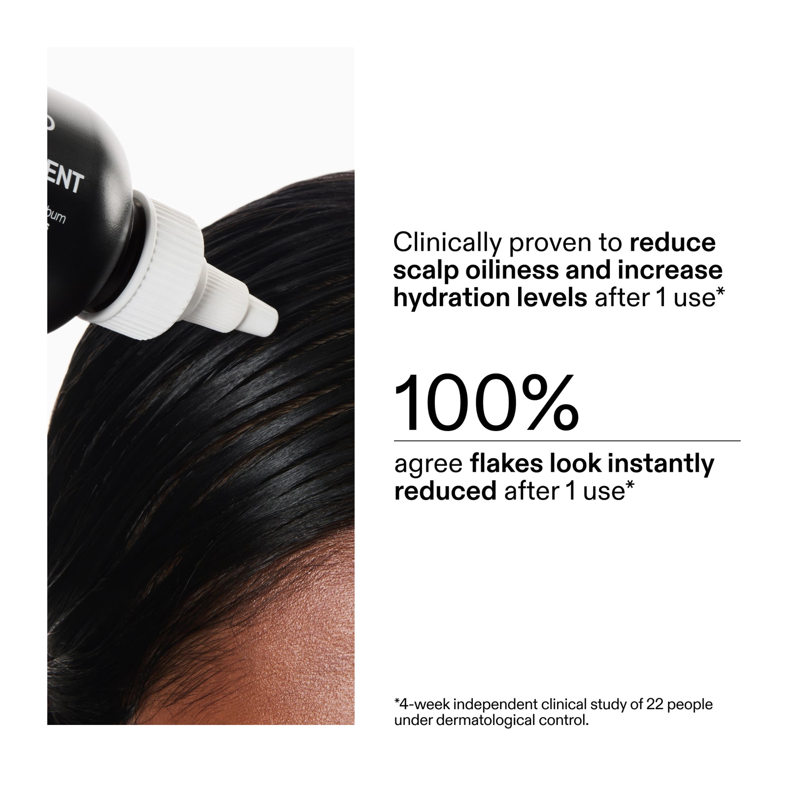 Salicylic Acid Exfoliating Scalp Treatment being applied to scalp with text about its effects on scalp oiliness and hydration.