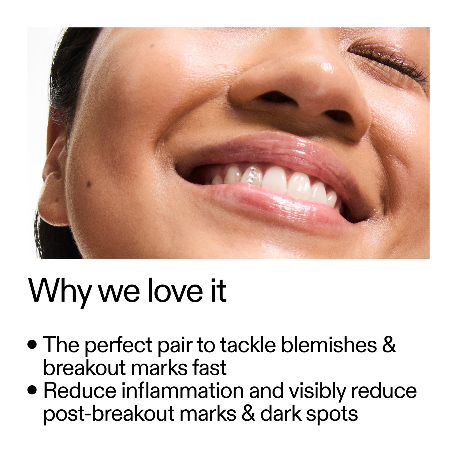 Close-up of a smiling person's face with text about skincare benefits.