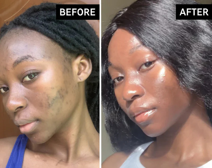 Before and after of a customers skin
