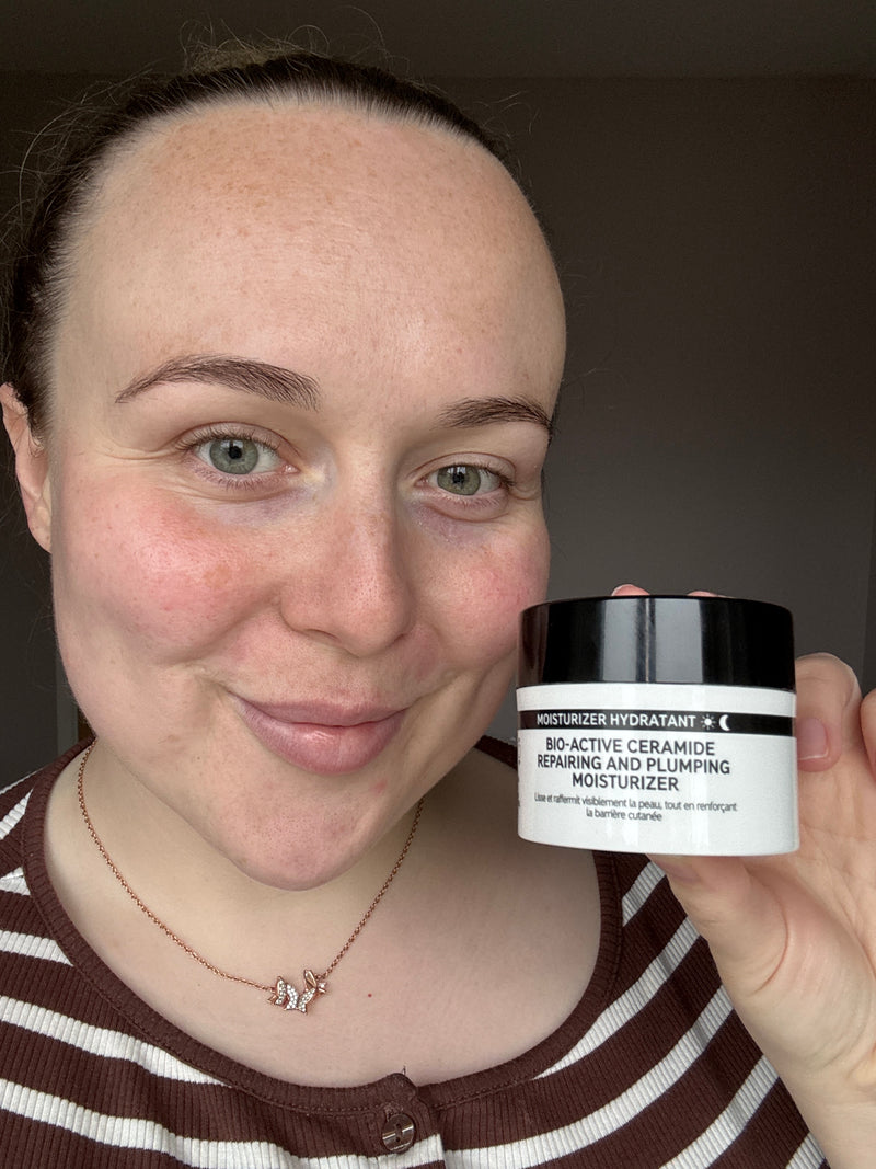 A woman holding a jar of Moisturizer next to her face, wearing a brown and white striped top.
