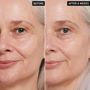 Before and after 6 weeks of using Retinol Eye Cream in skincare routine. Side by side results image.